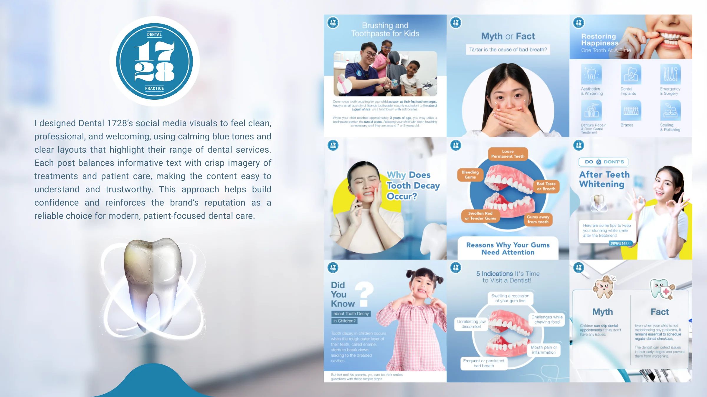 Dental 1728 social media posts in calm blue tones