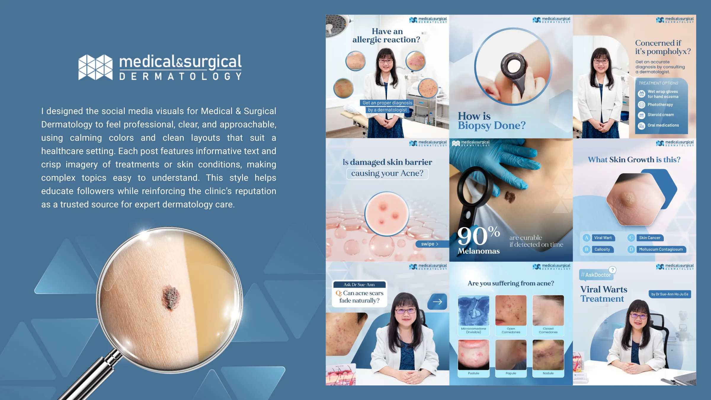 Medical & Surgical Dermatology social posts with a magnifying glass visual